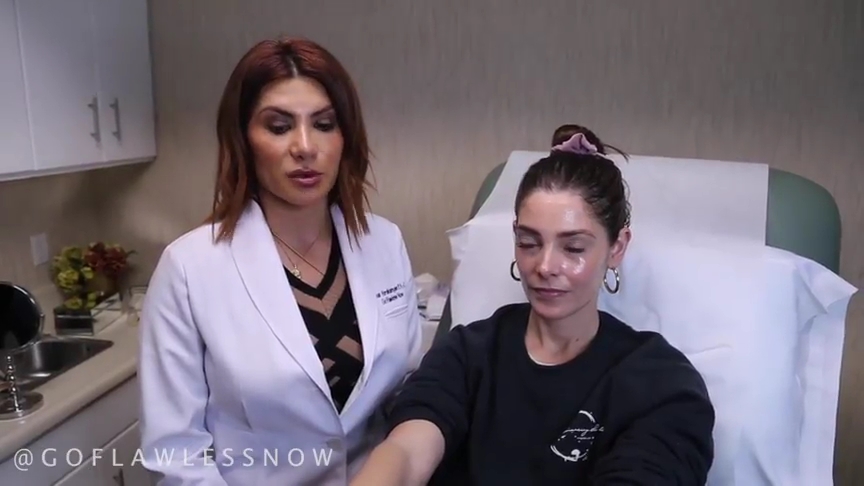 Ashley-Greene-dot-nl_2019GoFlawlessNow-VampireFacial0015.jpg
