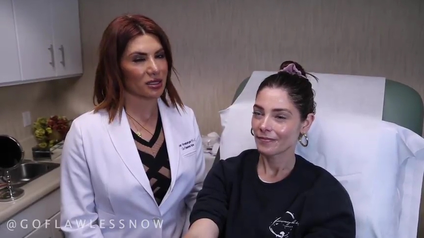 Ashley-Greene-dot-nl_2019GoFlawlessNow-VampireFacial0030.jpg
