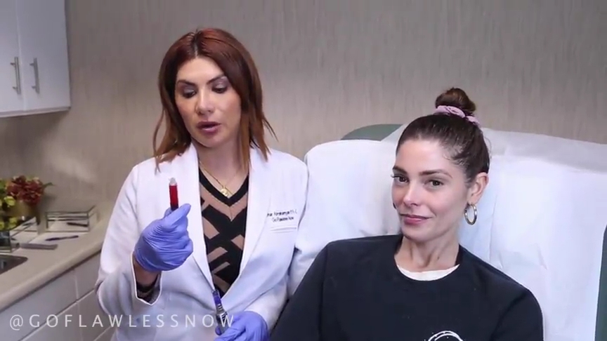 Ashley-Greene-dot-nl_2019GoFlawlessNow-VampireFacial0051.jpg