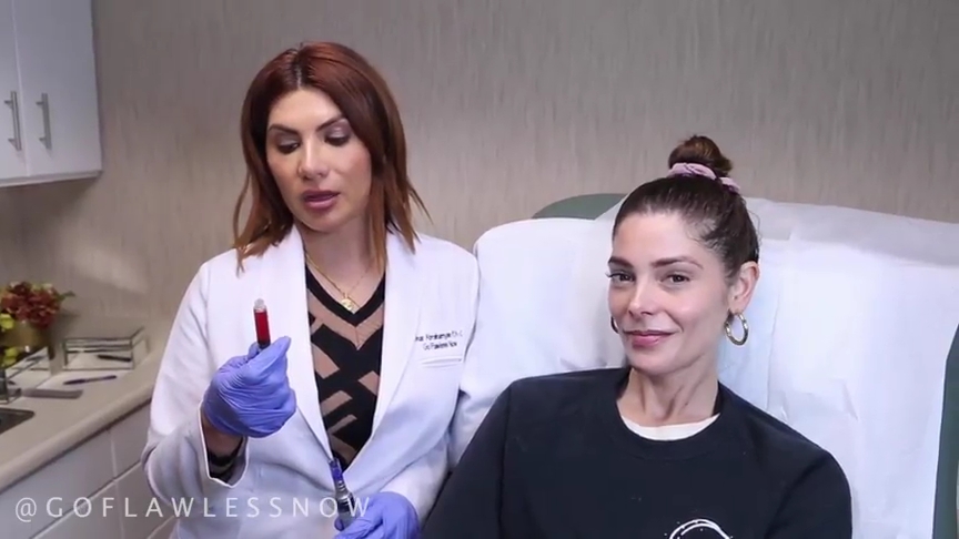 Ashley-Greene-dot-nl_2019GoFlawlessNow-VampireFacial0052.jpg