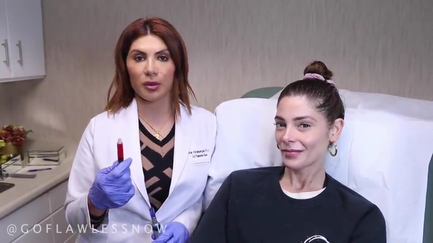 Ashley-Greene-dot-nl_2019GoFlawlessNow-VampireFacial0053.jpg