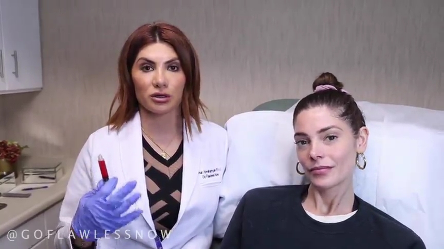 Ashley-Greene-dot-nl_2019GoFlawlessNow-VampireFacial0060.jpg