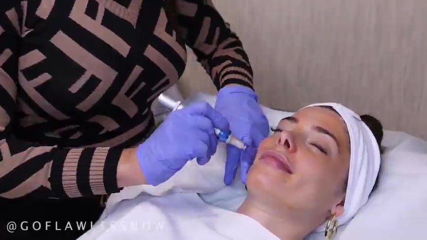 Ashley-Greene-dot-nl_2019GoFlawlessNow-VampireFacial0085.jpg