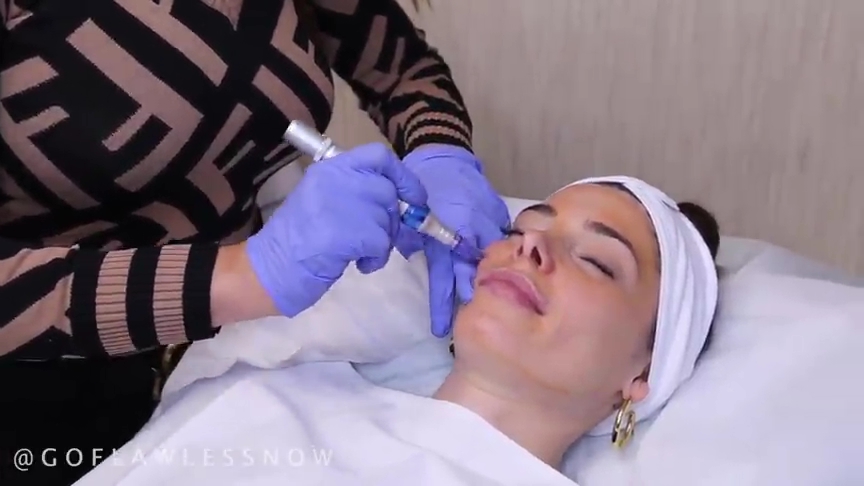 Ashley-Greene-dot-nl_2019GoFlawlessNow-VampireFacial0086.jpg