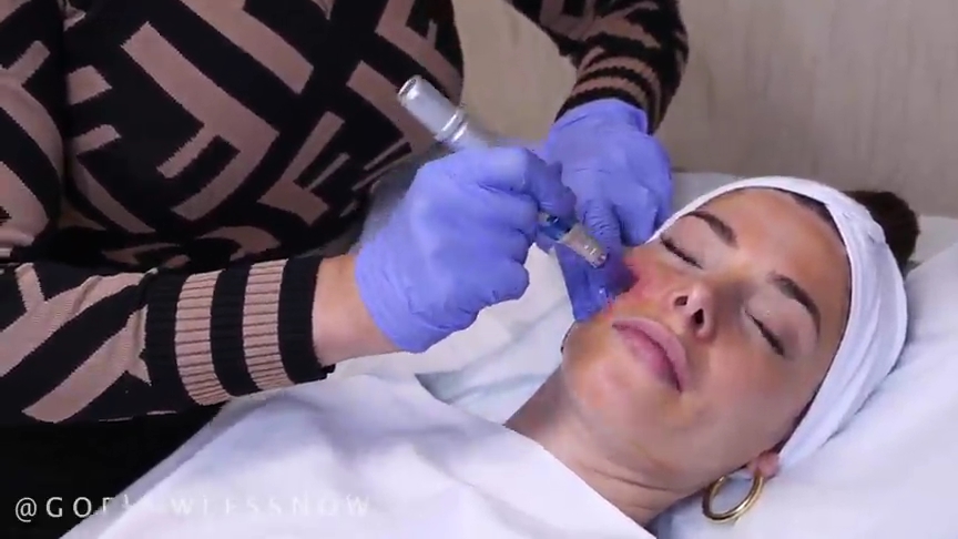 Ashley-Greene-dot-nl_2019GoFlawlessNow-VampireFacial0097.jpg
