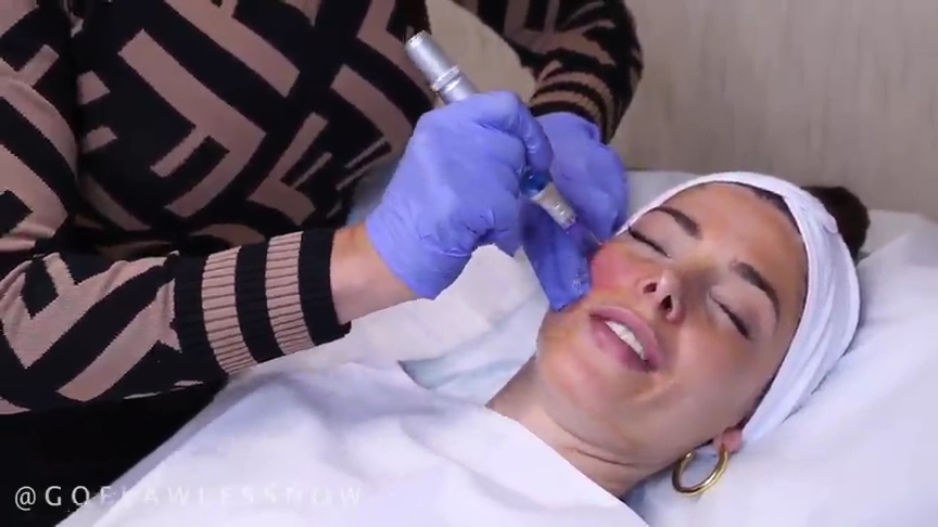 Ashley-Greene-dot-nl_2019GoFlawlessNow-VampireFacial0099.jpg